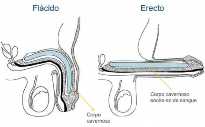 Médico Urologista para Aumento Peniana