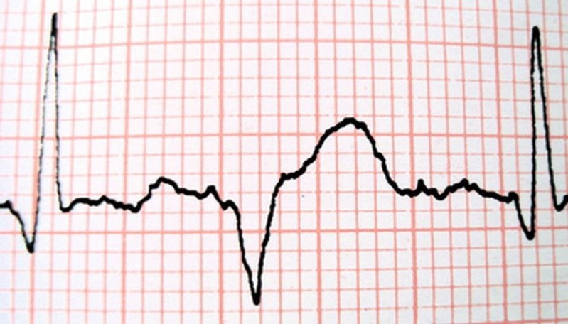 Médicos Cardiologistas Particulares