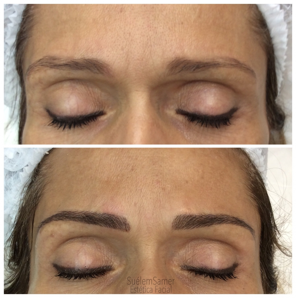 Microblading