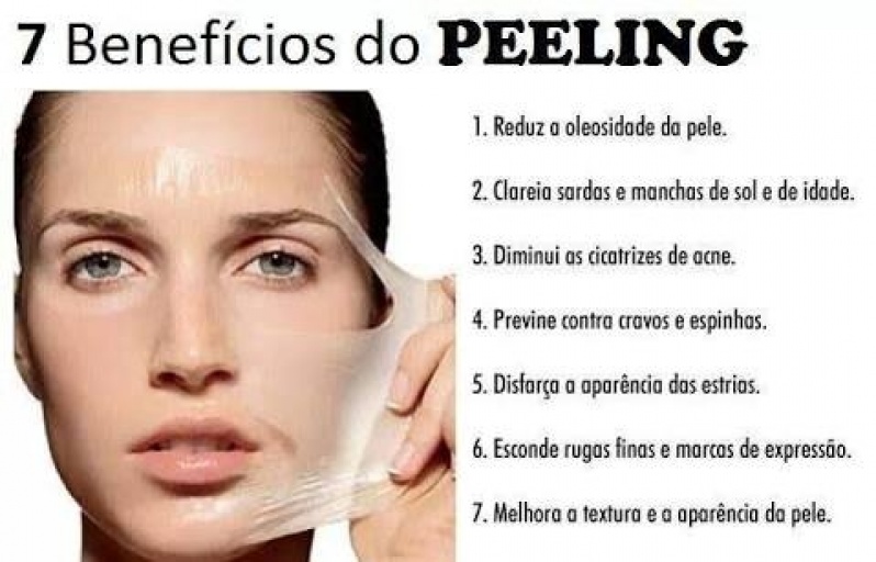 Peeling de Cristal Acne