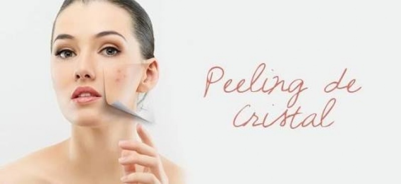 Peeling de Cristal Estrias