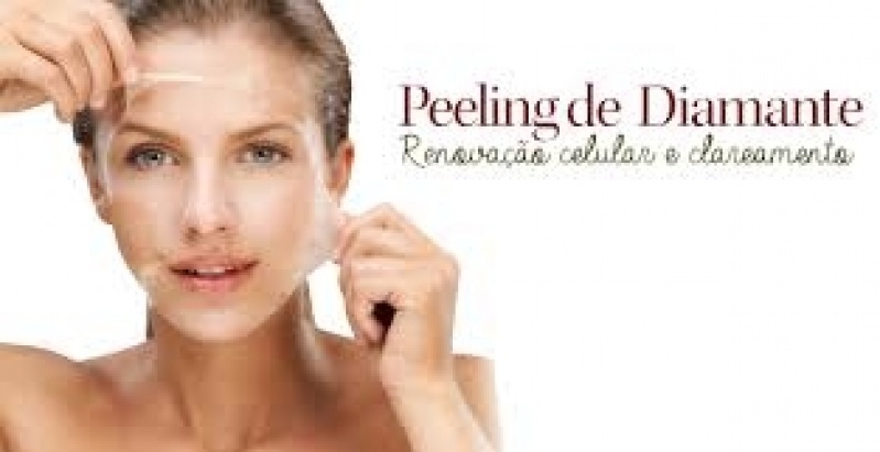 Peeling de Diamante para Cicatriz de Acne