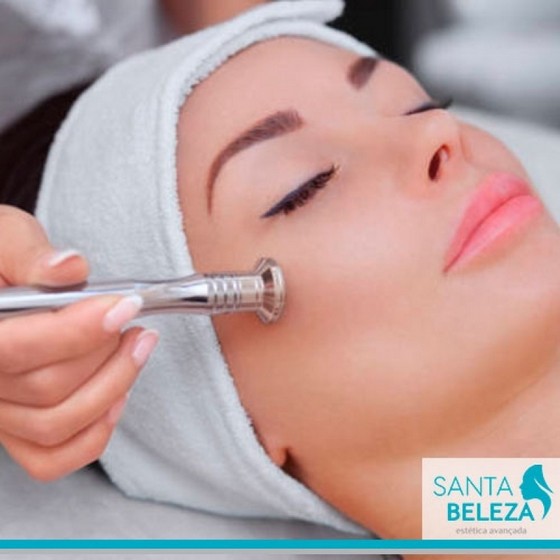 Peeling e Melasma