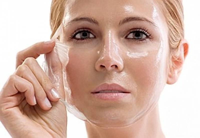 Peeling para Acne