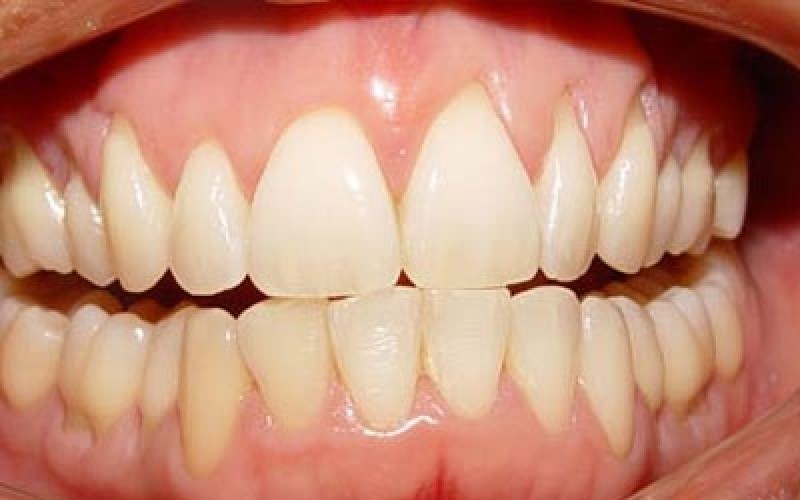 Periodontia em Embu das Artes