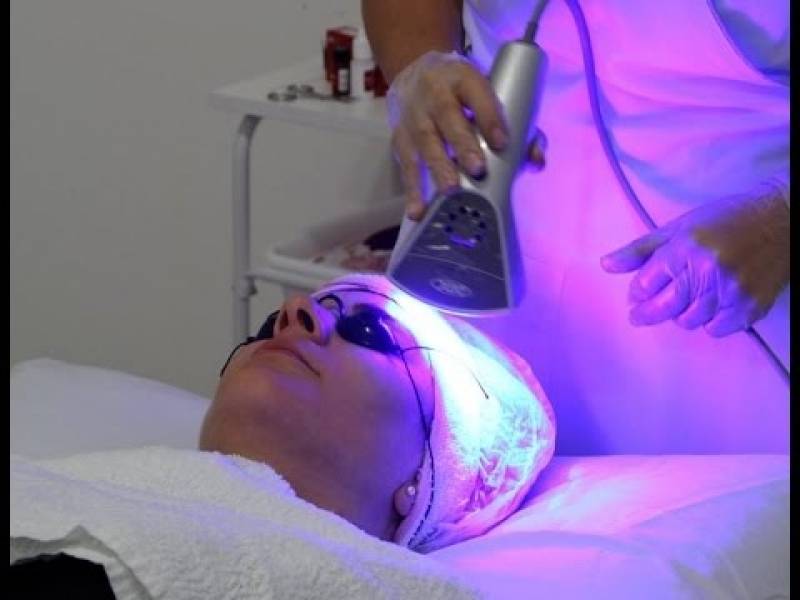 Plástica Biofotônica para Rejuvenescimento