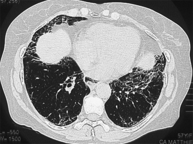 Pneumologista Especialista em Sinusite