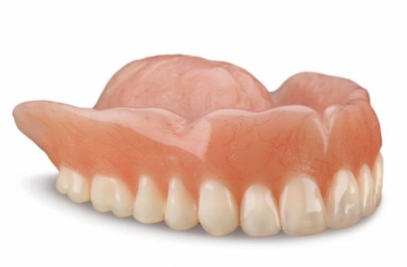 Prótese Dentária Adesiva