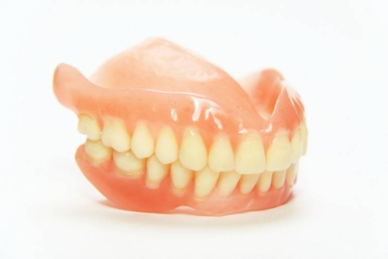 Prótese Dentária com Pino