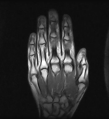 Ressonância Magnética da Mão em Guarulhos