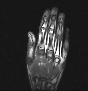 Ressonância Magnética da Mão em São Bernardo