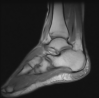Ressonância Magnética de Tornozelo na Zona Oeste