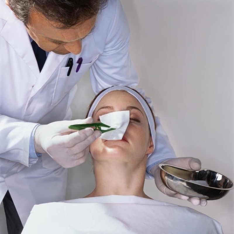 Rinoplastia Dorso Largo