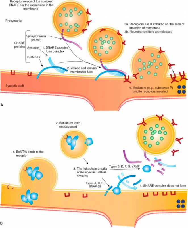 Toxina Botulínica para Distonia