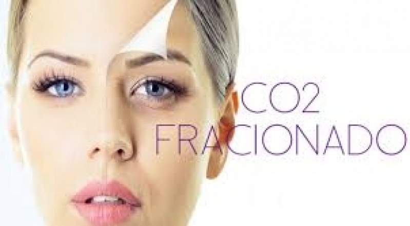 Tratamento com Microagulhamento Facial