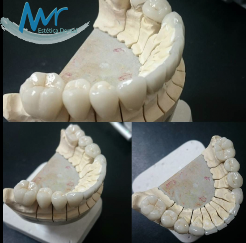 Tratamento Estético Dentário
