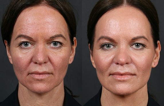 Tratamento Estetico Facial