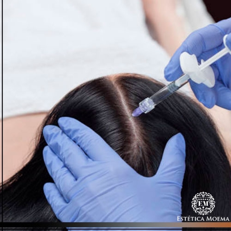 Tratamento Mmp para Alopecia