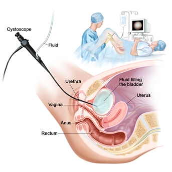 Tratamento para Engravidar com Clomid