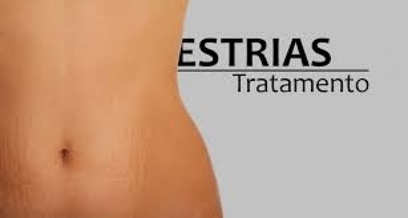 Tratamento para Estrias na Barriga