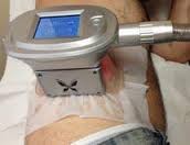 Velashape