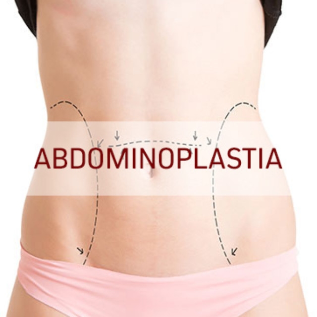 Abdominoplastia para Homens