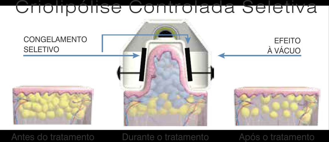 Aluguel de Equipamentos de Estética em Barueri