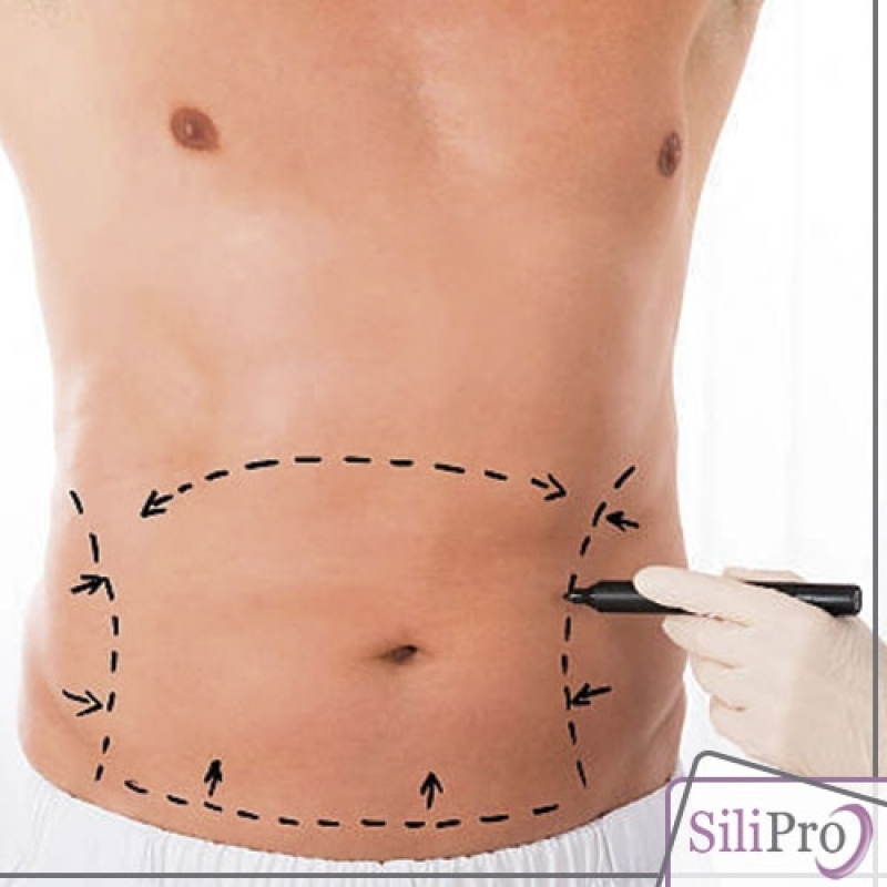 Cirurgia de Lipoaspiração