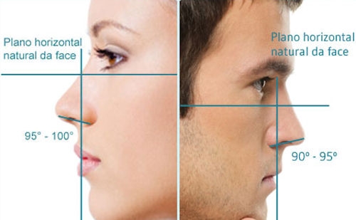 Cirurgia Plástica para Nariz