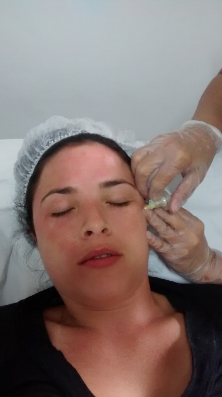 Clínica para Aplicação de Botox Corporal