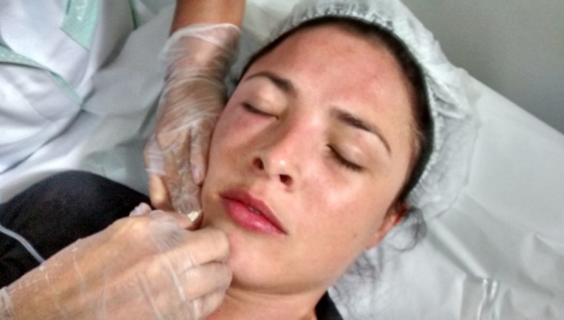 Clínica para Aplicação de Botox nas Axilas