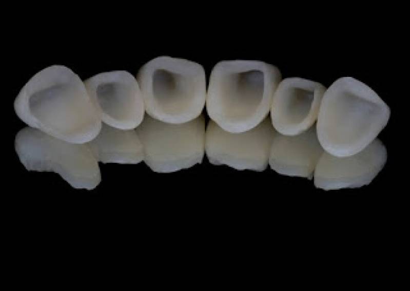 Clínica para Colocar Aparelho nos Dentes