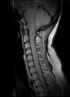 Ressonância Magnética da Coluna em Diadema