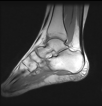 Ressonância Magnética do Tornozelo na Zona Sul