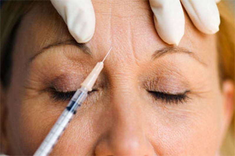 Tratamento com Botox para Sorriso Gengival