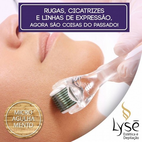 Tratamento com Microagulhamento Facial