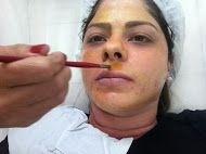 Tratamento Estetico Facial