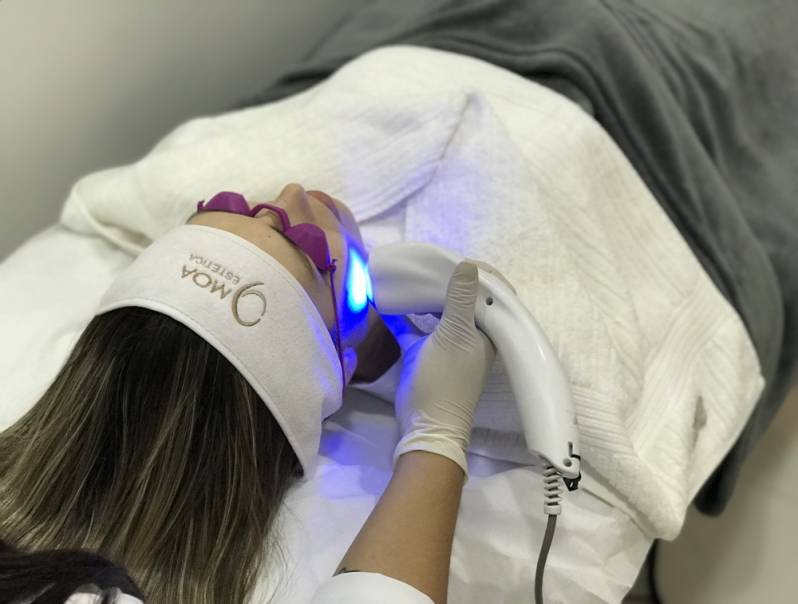 Tratamento Facial com Laser