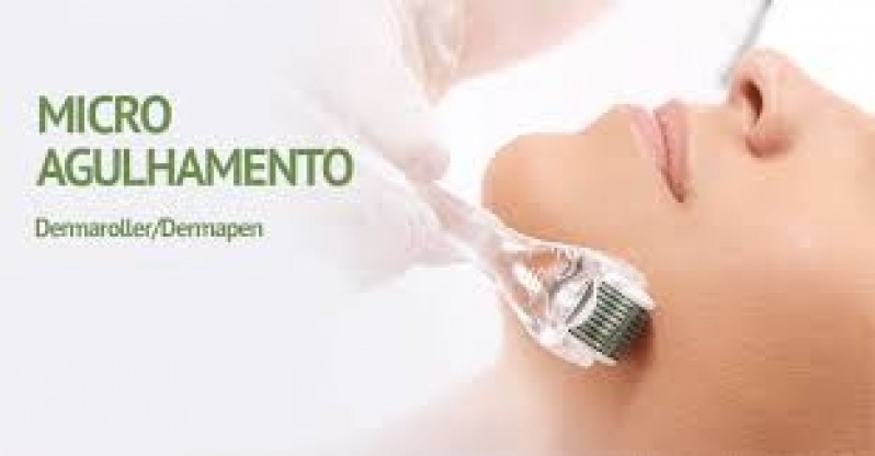 Tratamento Facial com Spectra