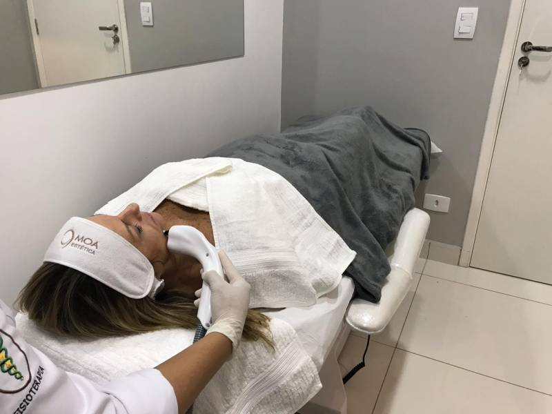 Tratamento Facial Microagulhamento