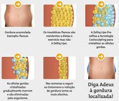 Tratamento Gordura Localizada